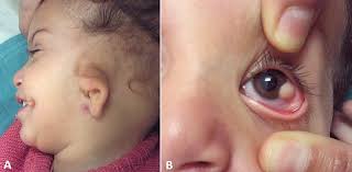 The Pan African Medical Journal Image Quiz