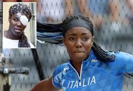Ecco come mi hanno ridotto i miei aggressori. Torna La Ragazza Colpita Dall Uovo Non C E Razzismo Ma Solo L Imbecillita Dei Giornalisti Azione Tradizionale