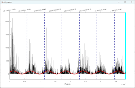 Image result for Actigraphy