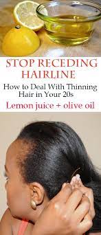 Receding Hairline In Women Causes And Best Natural Treatments Receding Hairline Treatment For Men Women Reg Hairline Treatment Hair Loss Women Regrow Hair