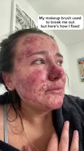 The new automatic brush cleaner save my face!#brushcleaner  #automaticbrushcleaner #makeupbrushes #acne #acnetreatment #makeupbrush