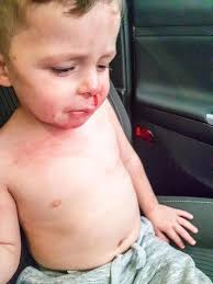 Anyone interested in air duct cleaning? We are charging a flat price for  the complete air duct cleaning. # ***🔴Our service package includes the  following:*** ✓Unlimited Ducts will be clean. # ✓Unlimited