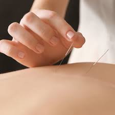 70 patientes avec des bouffées de chaleur modérées à sévères, score ⩾ 4 au msq (menoscores questionnaire), sont randomisées en deux groupes. Les Bienfaits De L Acupuncture Acupuncture Marie Eve Bordeleau