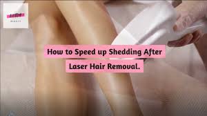 Use a sunscreen with an spf 50 or higher for two weeks before and after each treatment. How To Speed Up Shedding After Laser Hair Removal Ketchbeauty