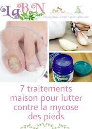 7 Traitements Maison Pour Lutter Contre La Mycose Des Pieds In 2020 Health