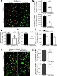 1,25(OH)2 Vitamin D Inhibits Foam Cell Formation and Suppresses Macrophage  Cholesterol Uptake in Patients With Type 2 Diabetes Mellitus