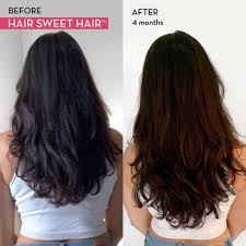 Iron plays an important part in hair health, as low levels of iron can lead to hair loss, and the fix may be as simple as adding an iron or vitamin supplement or adding lentils. Hair Sweet Hair Hair Growth Vegan Gummies With Biotin And Folic Acid Hum Nutrition Sephora
