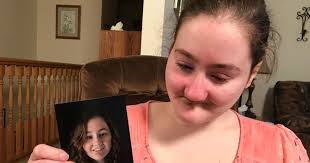 Minnesota girl who can't feel pain battles insurance company