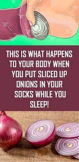 This Is What Happens To Your Body When You Put Sliced Up Onions In Your Socks While You Sleep Onion In Your Sock Onion In Sock What Happened To You