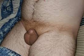 صغر القضيب - ويكيبيديا