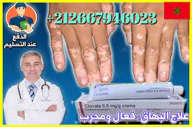 Sedef hastalığı, liken hastalığı, deride genellikle yüzde görülen plaklar. Clovate 0 5mg G Crema Payhip
