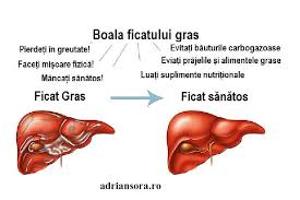 We did not find results for: Ficat Gras Cel Mai Bun Tratament De Urmat De Aici Incolo