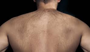 But you're more likely to cut yourself and introduce bacteria into the area. Thinking About Back Hair Removal These Are Your Best Options