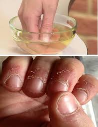 Are You Often Troubled By That Small Piece Of Torn Skin Around Your Nails Waiting To Snag On Your Cl Beauty Hacks Diy Beauty Beauty