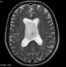 Pin On Neuro Caq 2