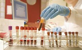 An antibody titer is a measurement of how much antibody an organism has produced that recognizes a particular epitope. How Antibody Titer Is Calculated