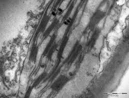 We did not find results for: File Chloroplast In Leaf Of Anemone Sp Tem 30000x Png Wikipedia