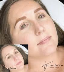 Fountain Aesthetic Artistry, 670 Meridian Way, Ste 283, Westerville, OH  43082, US