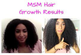 This will depend on several factors such as the following how can i use msm to promote hair growth? Msm Hair Growth Before And After Pictures Msm Powder Oil Results