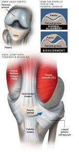 Image result for Patella Tracking Assessment