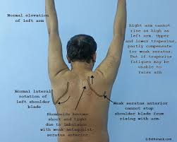 Pin On Trigger Point