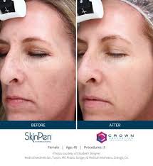 Reynolds Trimax fashionable Gel Pen Green