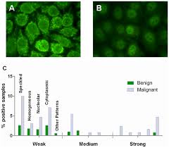 Image result for ANA Staining Pattern