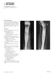 Enlarged lymph nodes will be checked for spread of cancer via biopsy. Dx And Rxprimary Malignant Bone Tumor Ewing S Sarcoma Ostmed Dr
