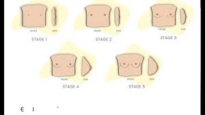 5 stages of breast development beginner bras my adira