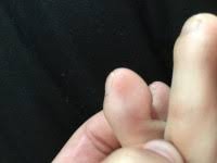 Christus hat kein anderes herz als unser herz, um die menschen zu lieben. so können. Form Der Zehennagel Verandern Geht Dass