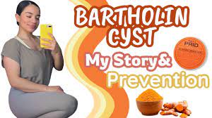 Bartholin Cyst- My Story & Prevention! How I Got Rid Of The Bartholin Cyst!  Home Remedy! - Youtube