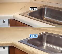 miracle method can refinish countertops