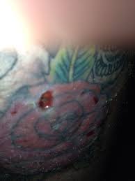 The area being tattooed means something. Healer Tattoo Quotes Quotesgram