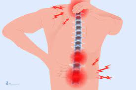 The facet joints are important for allowing rotation of the spine but may develop arthritis and become a source for low back or neck pain. Arthritis In The Back Symptoms Types Of Back Arthritis Treatment