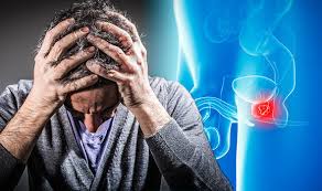 It may grow slowly and it's typically treatable. Prostate Cancer Symptoms Pain In The Back Hips Or Legs Can Indicate The Deadly Disease Express Co Uk