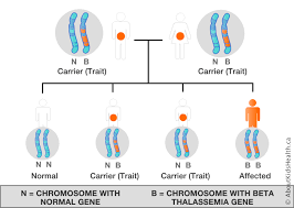 Thalassemia