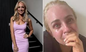Carrie Bickmore sparks concern as she shares confronting image red-faced  and teary eyed