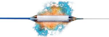 Image result for Urethral Stricture