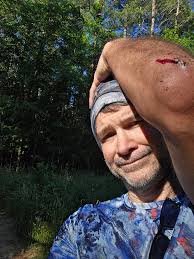 Dangers of trail running with ADHD