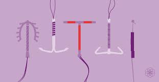 copper iud side effects reviews