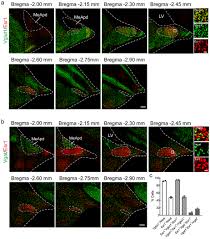 Fie cod special desi in cazul acesta contabilul tau va inregistra tva la aceasta factura atat ca tva deductibil, cat si ca tva colectat in. Posterior Amygdala Regulates Sexual And Aggressive Behaviors In Male Mice Abstract Europe Pmc