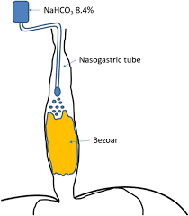 Image result for Bezoar