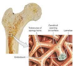 Cancellous bone , also called trabecular bone or spongy bone , light, porous bone enclosing numerous large spaces that give a honeycombed or spongy appearance. 6 4 Compact Bone Contains Parallel Osteons And Spongy Bone Contains Trabeculae Anatomy Class Orthopedic Surgery Radiology