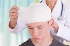 Orange County Traumatic Brain Injury Attorney