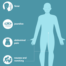 We did not find results for: Gallbladder Disease Signs Symptoms And Complications