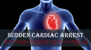 To understand the difference between the two, you will have to look for the difference in symptoms between these two. Sudden Cardiac Arrest What Is It And What Can You Do About It Myheart