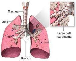 Here's how how to tell. Lungs All Feline Hospital Located 2300 S 48th St Suite 3 Lincoln Ne 68506