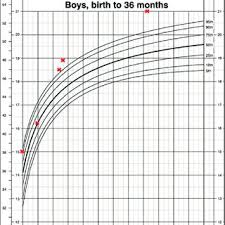 Head Circumference Chart Showing Macrocephaly Download