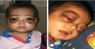 That happens to other people's. Little Baby Has Cancer A Dangerous Spam On Facebook Ayupp News