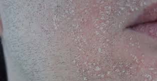 Feb 11, 2016 · j'espère que cet article vous a aidé à en savoir plus pour choisir un soin visage homme adapté à vos besoins et vous aidera à prendre soin de votre peau d'homme. Soin Visage Peau Seche Des Produits Pour Vous Embellir